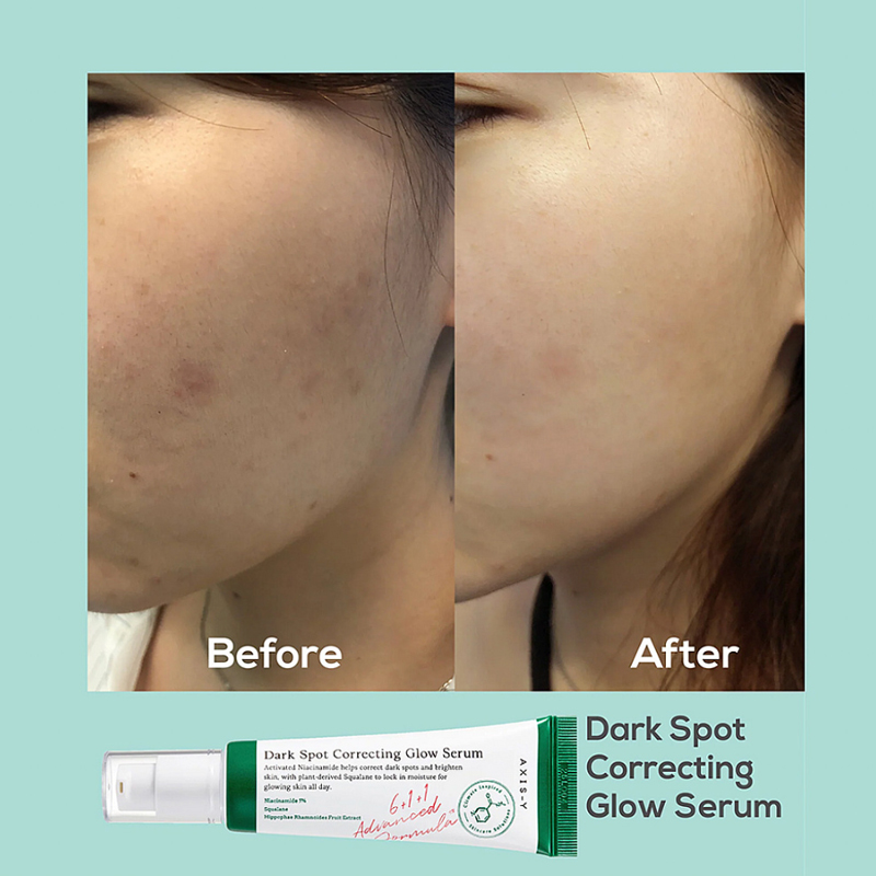 AXIS-Y-Dark-Spot-Correcting-Glow-Serum-2