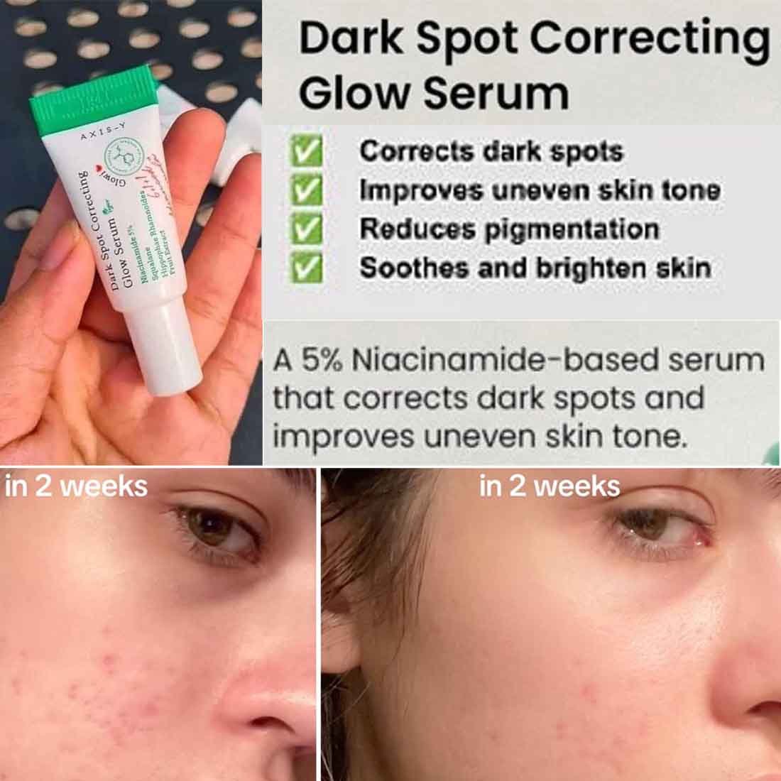 Axis-Y-Dark-Spot-Correcting-Serum